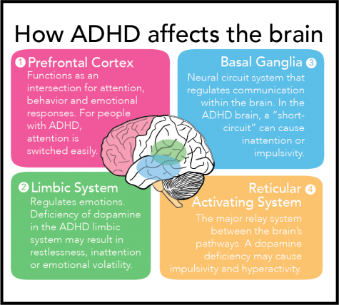 attention deficit hyperactivity disorder brain